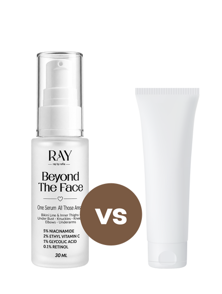 Comparison