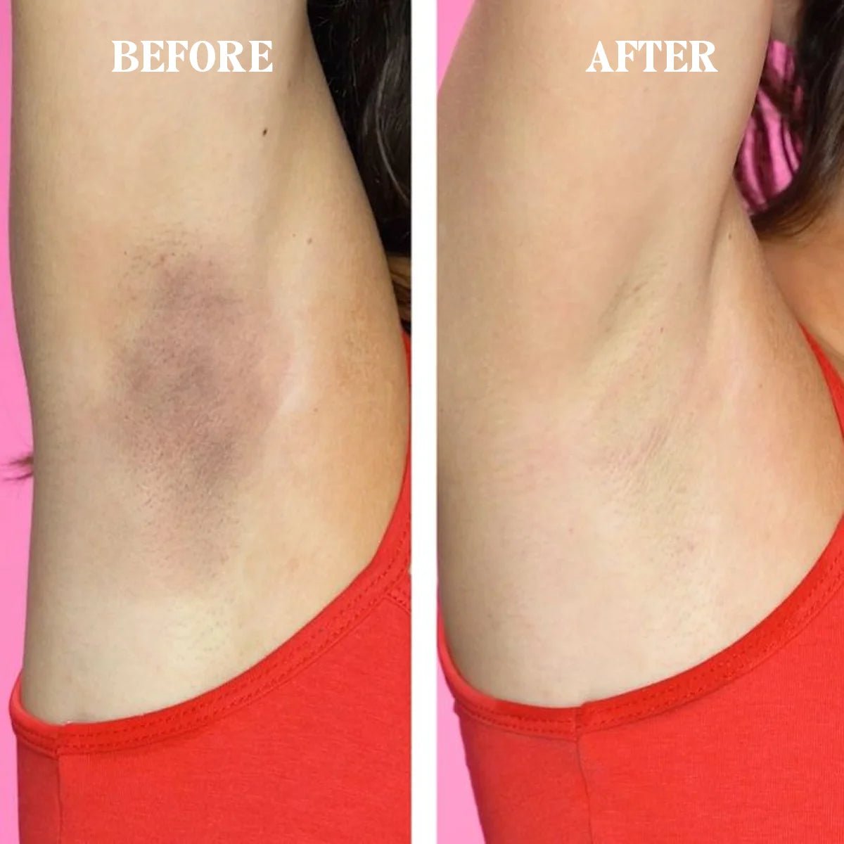 Time To Shine (Under Arm Serum) - RaybyrafiaTime To Shine (Under Arm Serum)RaybyrafiaRaybyrafia10000Time To Shine (Under Arm Serum)Time To Shine (Under Arm Serum)