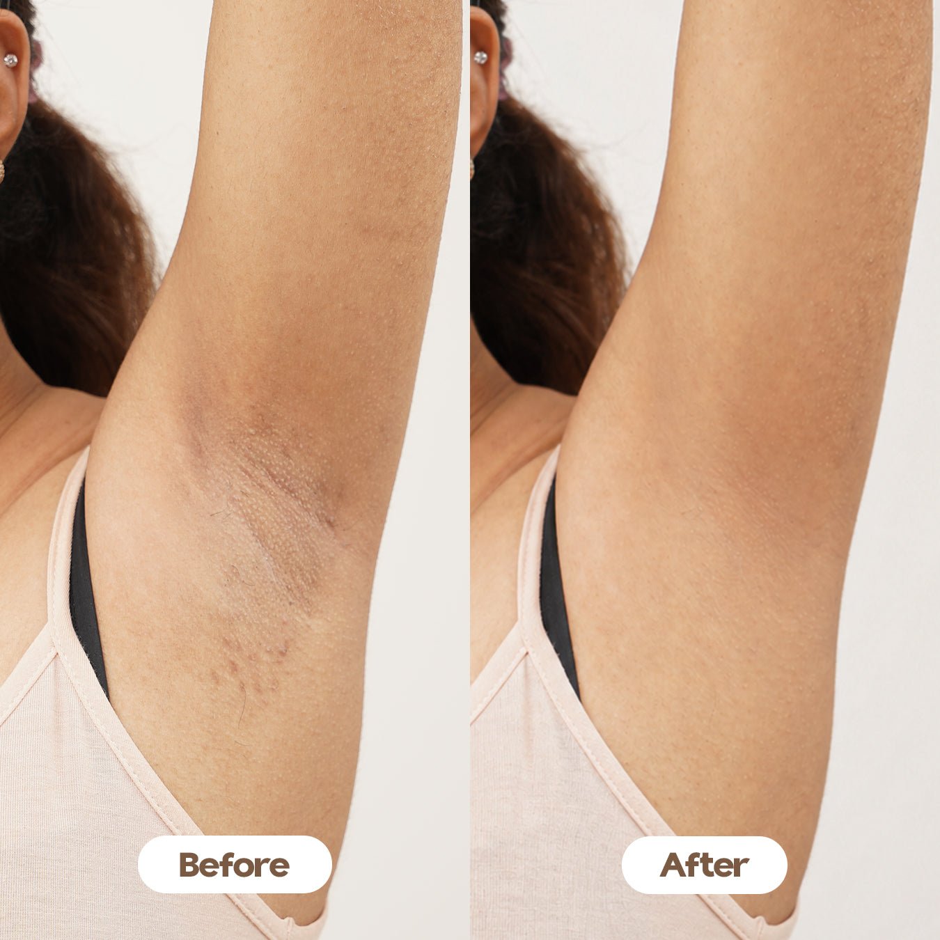 Time To Shine (Under Arm Serum) - RaybyrafiaTime To Shine (Under Arm Serum)RaybyrafiaRaybyrafia10000hide - imghide - img